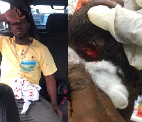 Singer, Orezi Survives Car Crash On Third Mainaland Bridge, Suffers ‘Broken Jaw’ 2