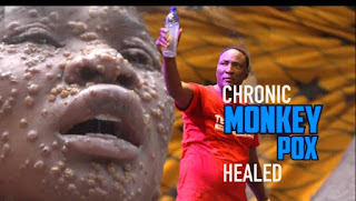 Woman Miraculously Healed Of Monkey Pox at Prophet Fufeyin’s Church 2