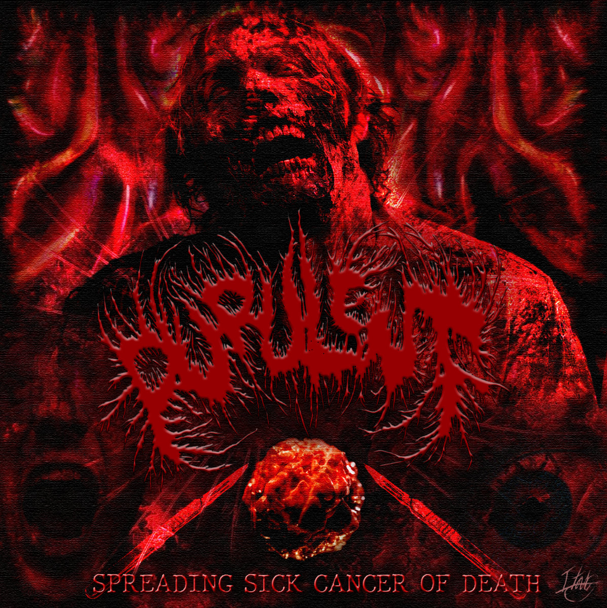 Sickbeet Dying of Cancer Zip Download